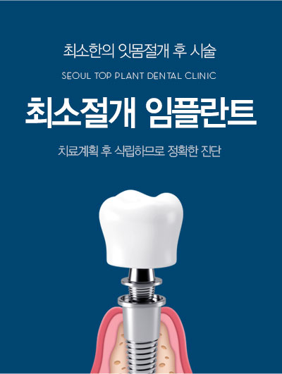 �ּ����� ���ö�Ʈ