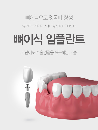 ���̽� ���ö�Ʈ